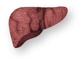 Liver with Cirrhosis